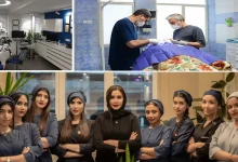 بهترین مرکز فیلر زیر چشم تهران